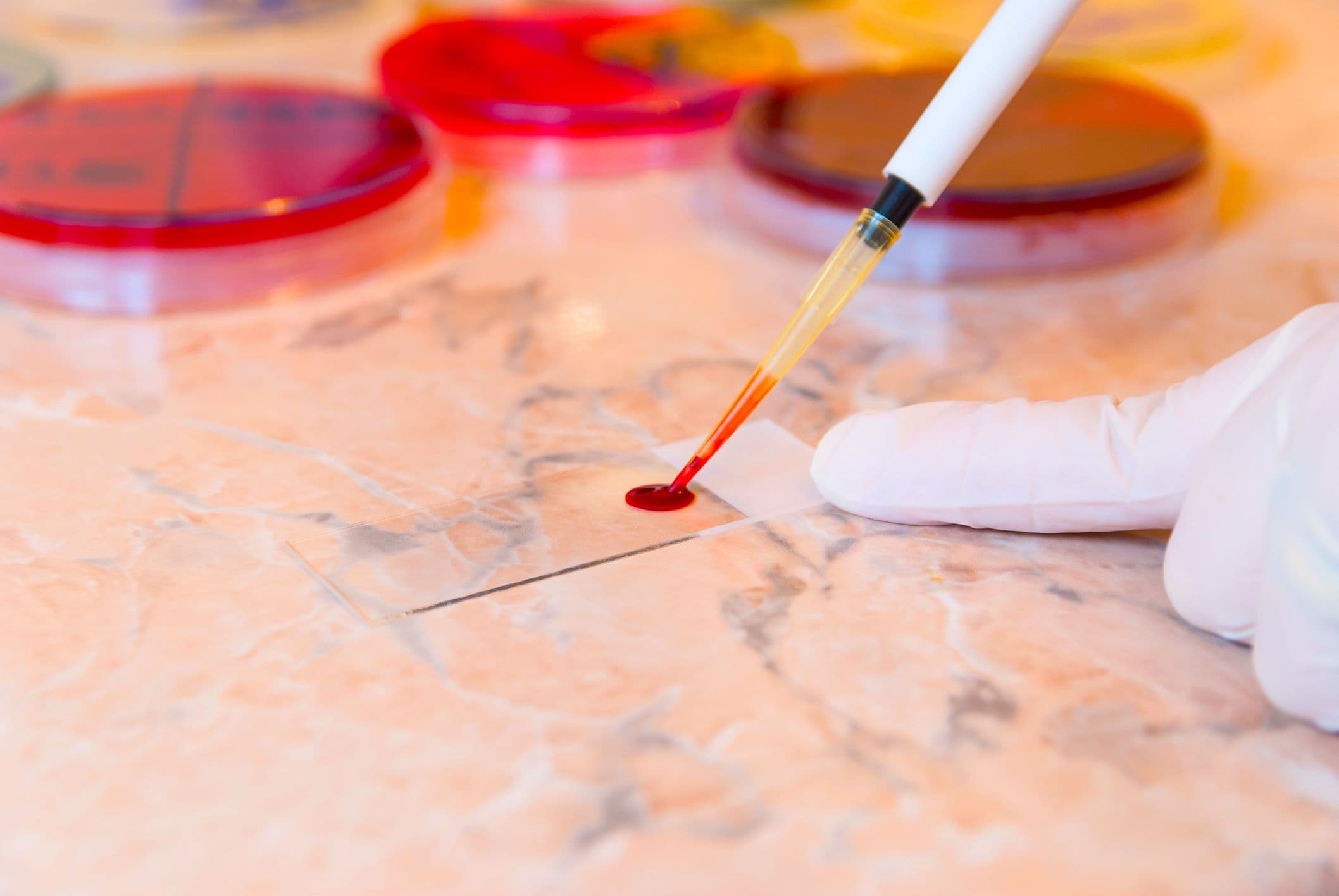 Article Placeholder image